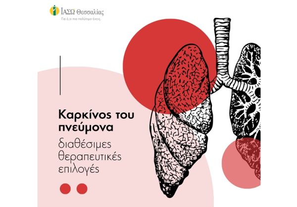ΙΑΣΩ Θεσσαλίας: Καρκίνος του Πνεύμονα – Τα στάδια και οι θεραπείες
