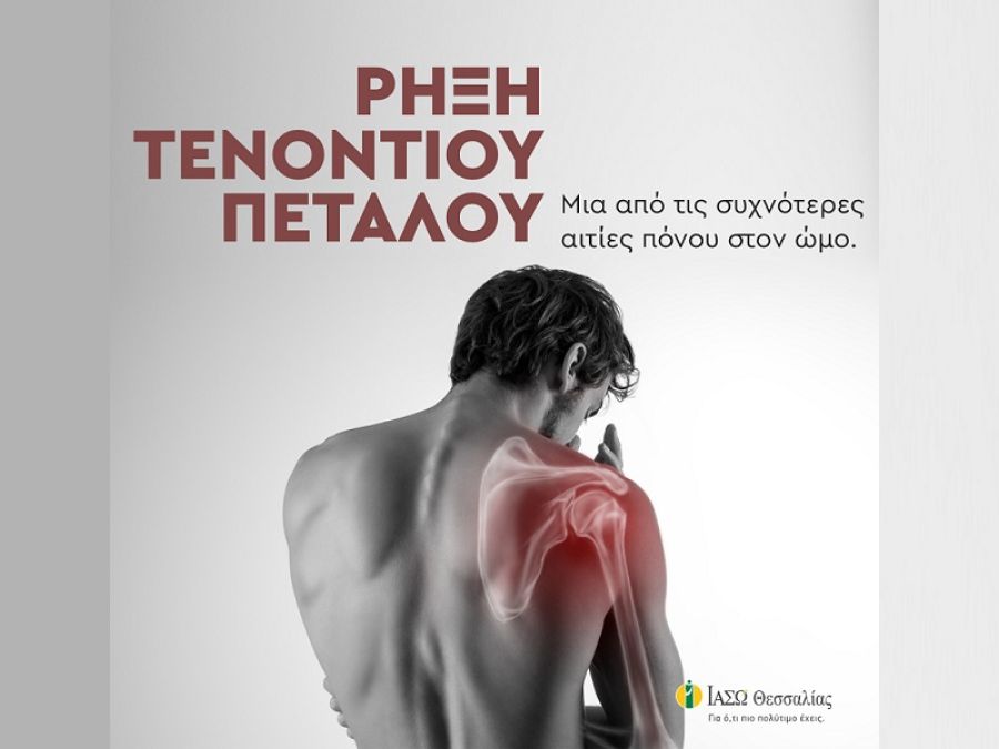 ΙΑΣΩ Θεσσαλίας: Ρήξη τενοντίου πετάλου. Μία από τις συχνότερες αιτίες πόνου στον ώμο