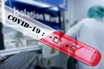 Δήμος Παλαμά: Rapid tests για COVID-19 στην Αγία Τριάδα την Τετάρτη 03 Φεβρουαρίου