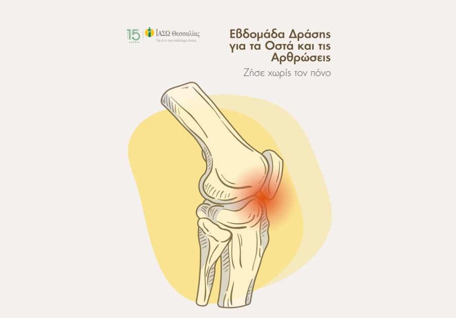 ΙΑΣΩ Θεσσαλίας: Όσα πρέπει να ξέρουμε για την Οστεοαρθρίτιδα του Γόνατος