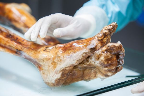 Ερευνητές κατάφεραν να αποκτήσουν λεπτομερή εικόνα του μικροβιώματος του Ότζι (Ανθρώπου των Πάγων)