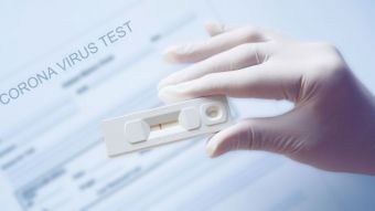 Ένα θετικό rapid test στη τοπική κοινότητα Ματαράγκας τη Μ. Δευτέρα 26/4