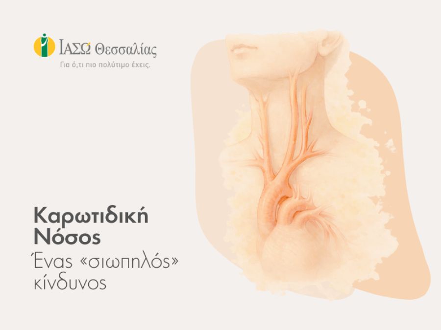ΙΑΣΩ Θεσσαλίας: Η καρωτιδική νόσος, ένας «σιωπηλός κίνδυνος»