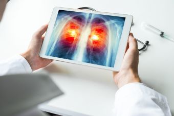 Ετήσιο έλεγχο για καρκίνο του πνεύμονα συνιστά η Αμερικανική Αντικαρκινική Εταιρεία σε όσους καπνίζουν ή κάπνιζαν παλαιότερα