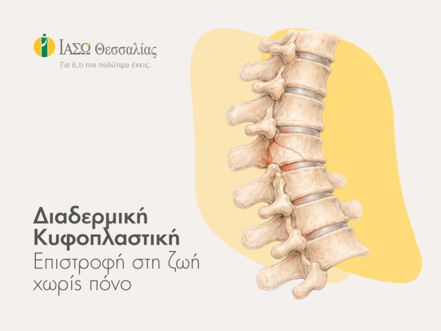Διαδερμική κυφοπλαστική: Λύση χωρίς ανοικτό χειρουργείο για το κάταγμα σπονδύλου