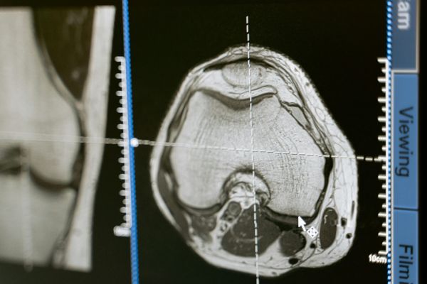 Όταν η πρόληψη χρειάζεται καθαρή εικόνα: ο ρόλος της μαγνητικής τομογραφίας στην Κρήτη