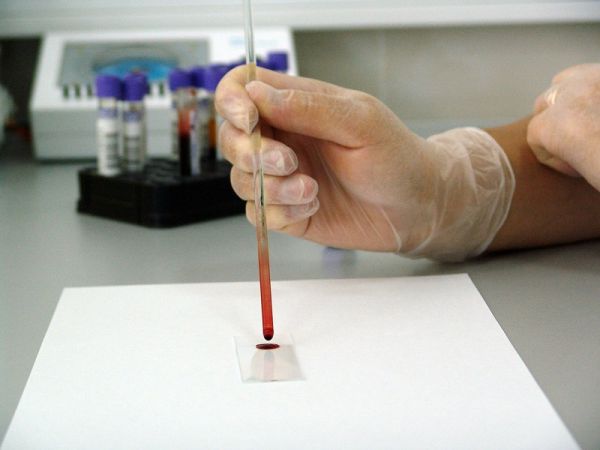 Η FDA ενέκρινε το πρώτο διαγνωστικό τεστ αυτο-ελέγχου για COVID-19. Aποτελέσματα σε 30 λεπτά