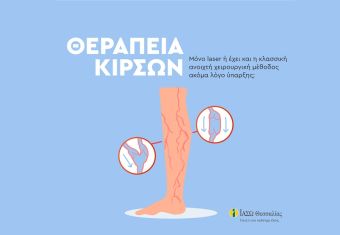 ΙΑΣΩ Θεσσαλίας: Θεραπεία κιρσών; Laser ή κλασσική ανοικτή χειρουργική μέθοδος;