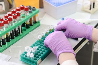 Εμβόλιο Οξφόρδης – AstraZeneca: Ασφαλές και με απίστευτα καλά νέα από τις δοκιμές