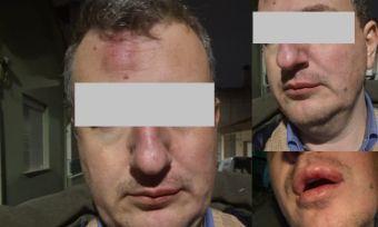 Γρονθοκόπησαν τον ιδιοκτήτη της εφημερίδας "Μαγνησία" Αρχιμήδη Καρεκλίδη έξω από το σπίτι του
