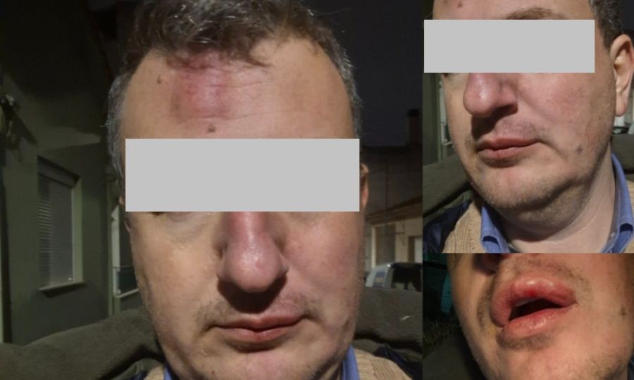 Γρονθοκόπησαν τον ιδιοκτήτη της εφημερίδας "Μαγνησία" Αρχιμήδη Καρεκλίδη έξω από το σπίτι του