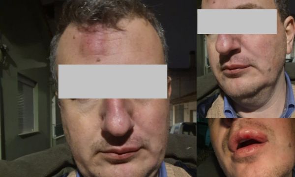 Γρονθοκόπησαν τον ιδιοκτήτη της εφημερίδας "Μαγνησία" Αρχιμήδη Καρεκλίδη έξω από το σπίτι του