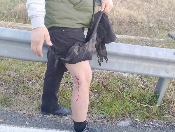 Πανελλαδική Επιτροπή των Μπλόκων: "Άνανδρη και βάρβαρη η επίθεση των αστυνομικών στην Καρδίτσα"