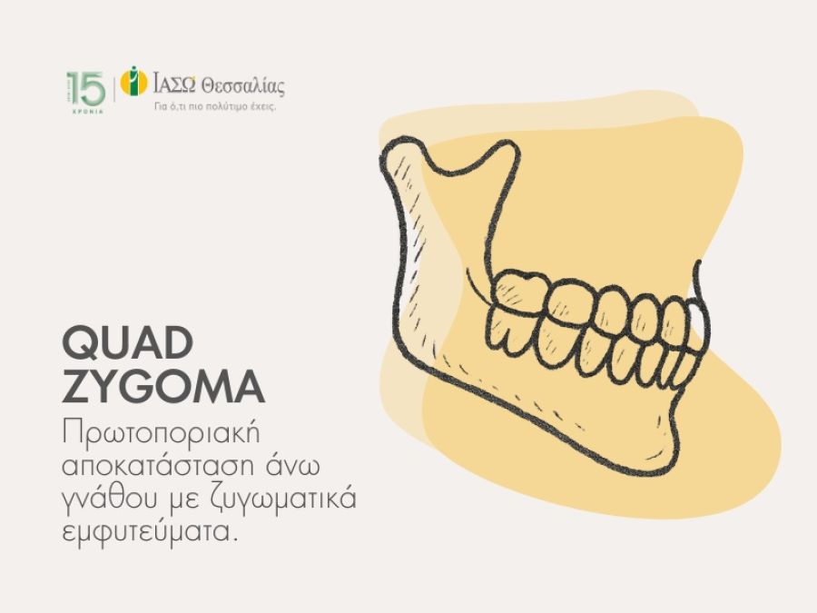Ιασώ Θεσσαλίας: QUAD ZYGOMA - Μία πρωτοποριακή τεχνική αποκατάστασης της σοβαρής ατροφίας άνω γνάθου με Ζυγωματικά εμφυτεύματα και άμεση φόρτιση